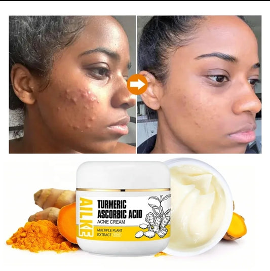 Turmeric Acne Cream