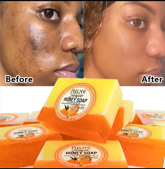 Handmade Turmeric Honey Soap