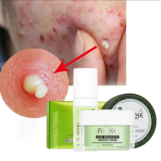 3-1 Acne Treatment Set