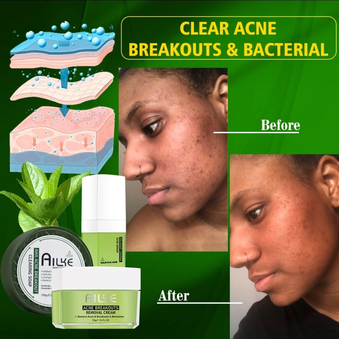 3-1 Acne Treatment Set