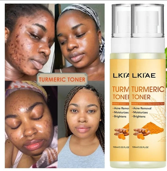Turmeric VC Toner